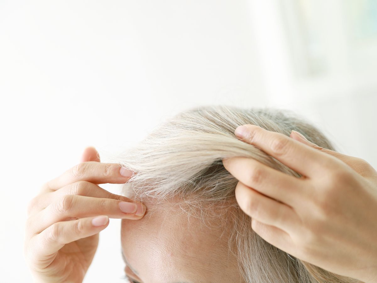 Hair loss & thinning hair mistakes to avoid