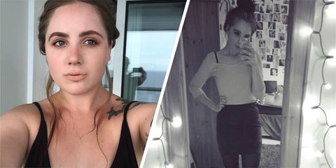"I saw myself four times bigger than I was" - What it’s like to live with body dysmorphia