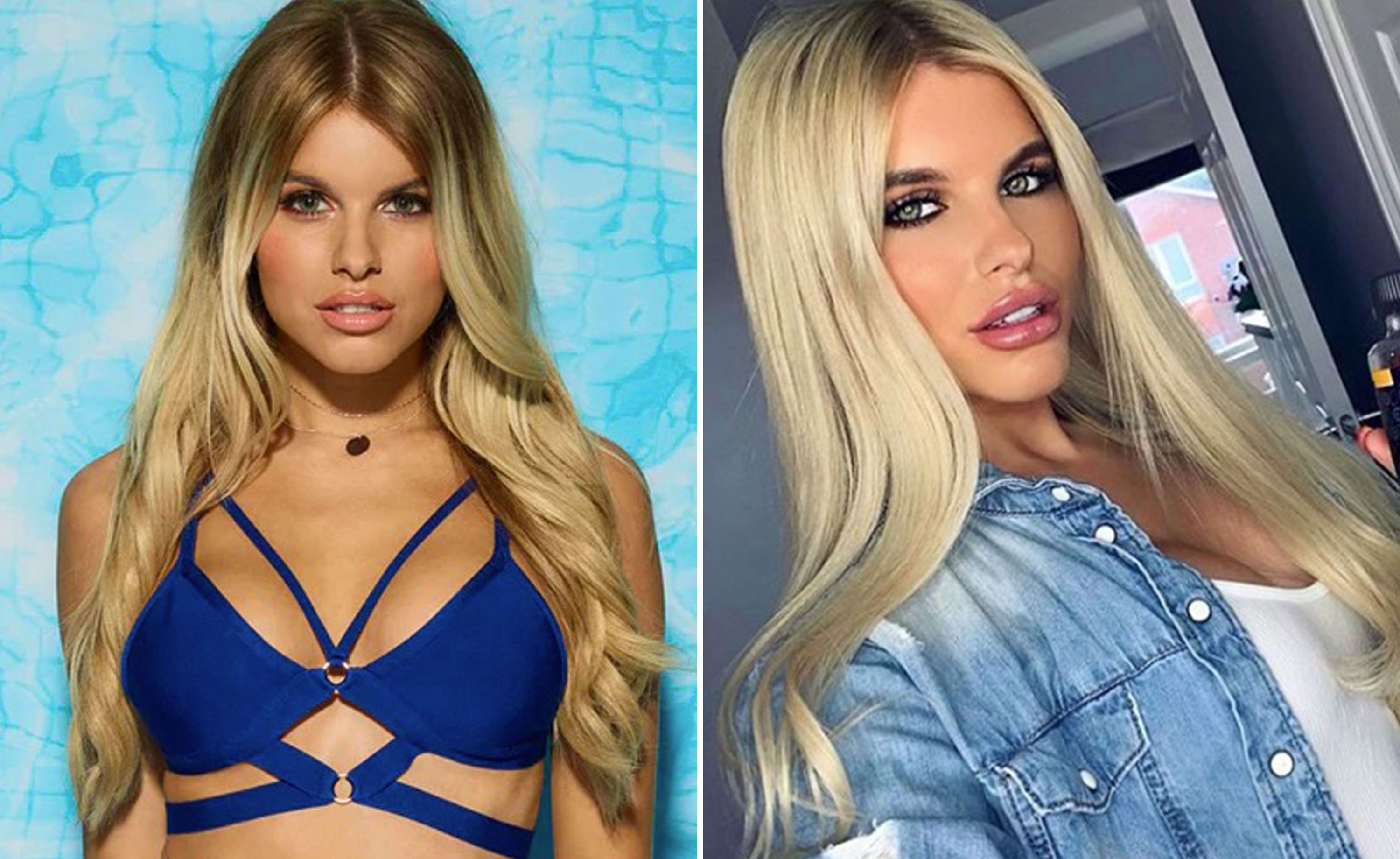 Love Island Transformations The Most Dramatic Before And Afters Hayley is from sydney, australia. love island transformations the most