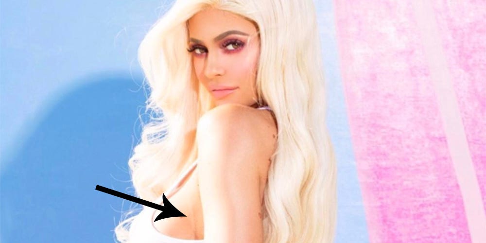 Plastic Carpet Cover >> Kylie Jenner Plastic Surgery Scar- Kylie Jenner Flaunt Magazine Plastic Carpet Cover >> Kylie Jenner Plastic Surgery Scar- Kylie Jenner Flaunt Magazine
