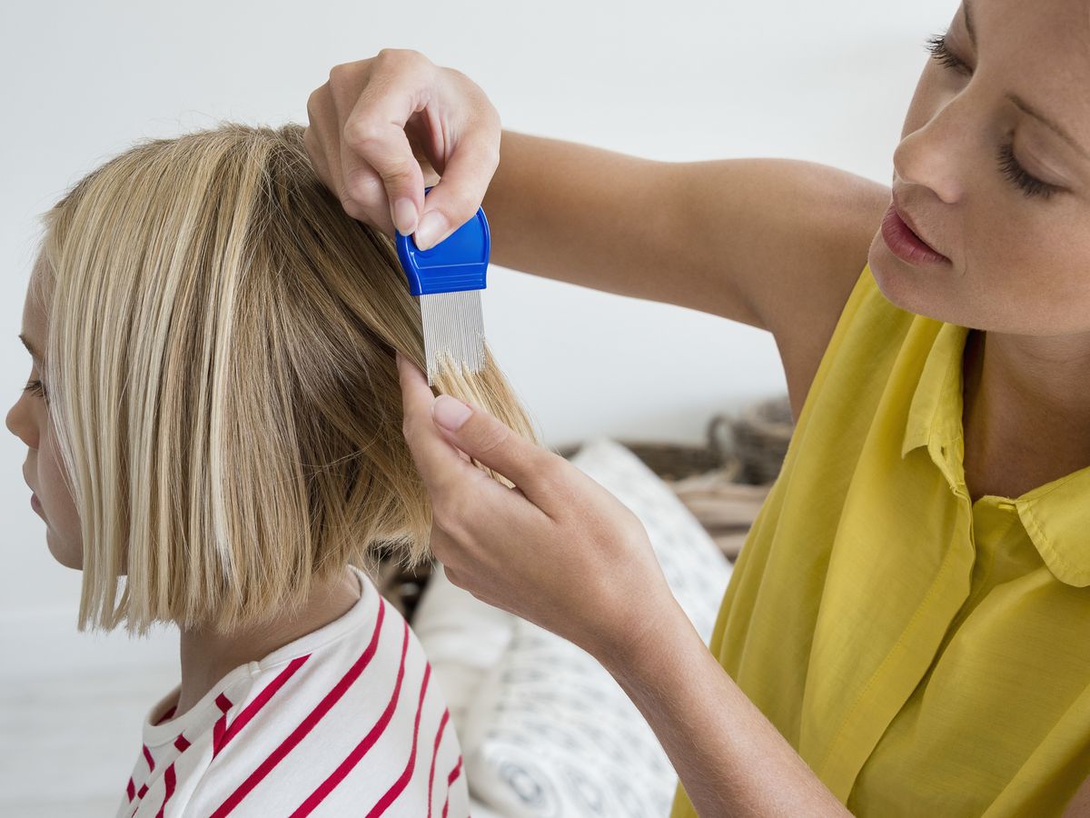 7 best head lice treatments 2022: How to treat nits