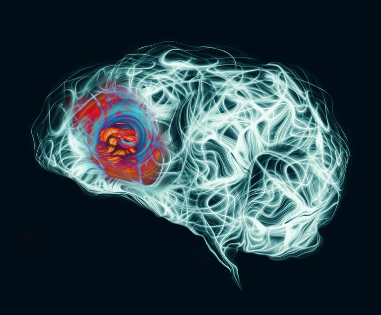 Migrañas: cómo enfrentarnos a ellas y encontrar una solución eficaz headache at front of brain royalty free image 1626951578