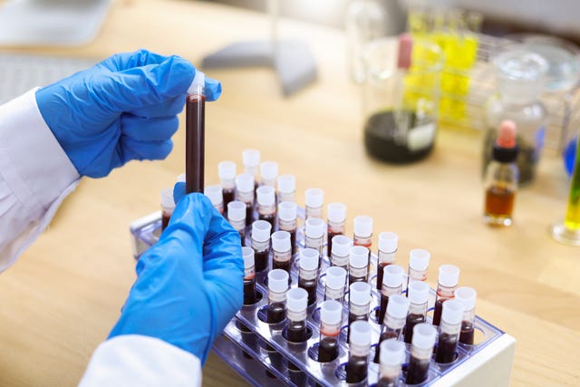 Cancer Blood Screening - Blood Test Spots Cancer Before Symptoms?
