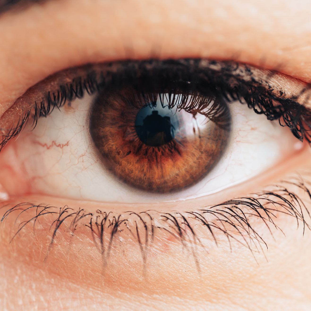 So … a Bunch of People Got Eye Syphilis