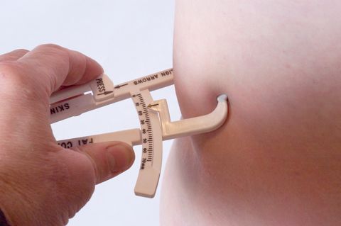 判斷「胰島素型肥胖」的特徵
