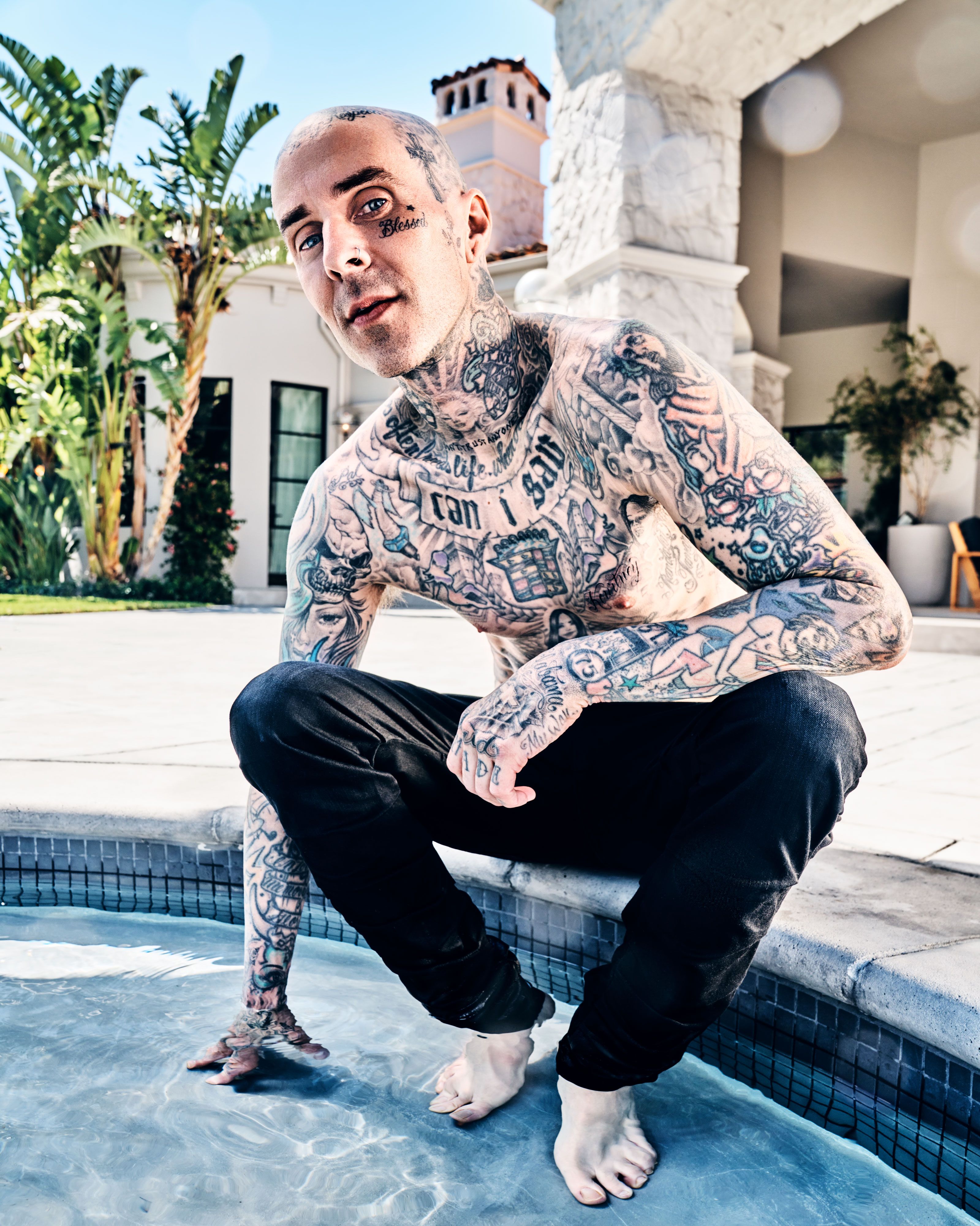 Hospital Travis Barker Burns - bmp-cyber