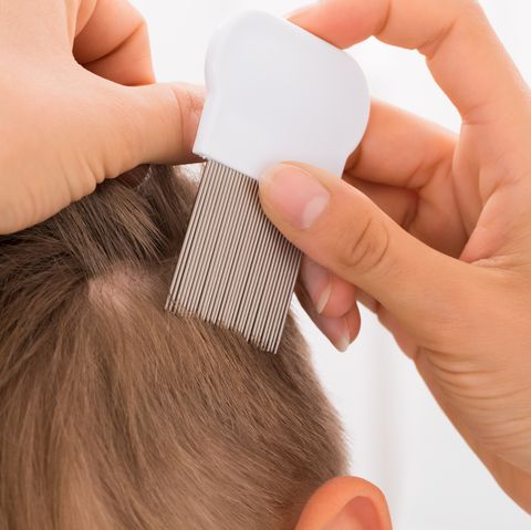 Natural Remedies For Lice How To Get Rid Of Head Lice And Nits