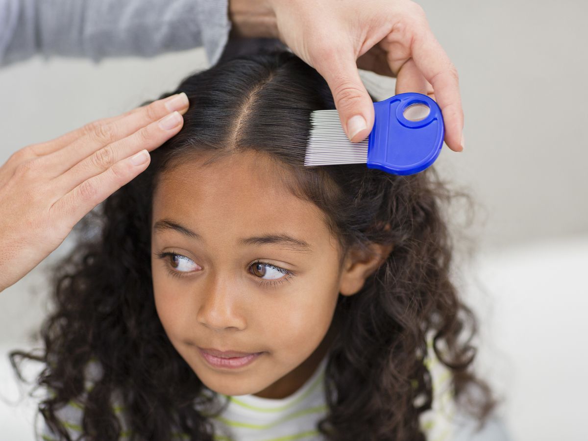 Head lice and nits: risk, detection, treatment and prevention