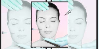 Qué es la huella estética y cómo prevenirla qué es la huella estética y cómo prevenirla