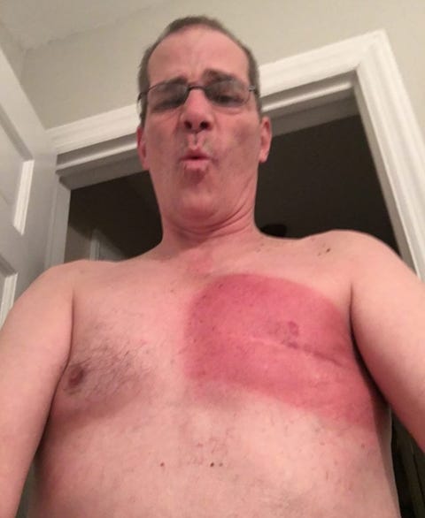 male breast cancer is rare but john falk beat it twice