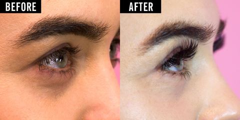 What are eyelash extensions?