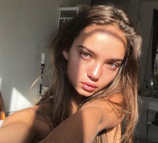 Model Inka Williams Shares Her Battle With Acne Which She Claims Was 8791