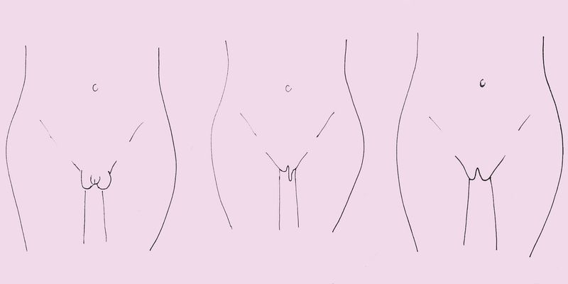 what should a vag look like