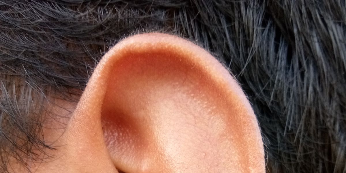 Dry Skin in Ears: Causes and Treatment
