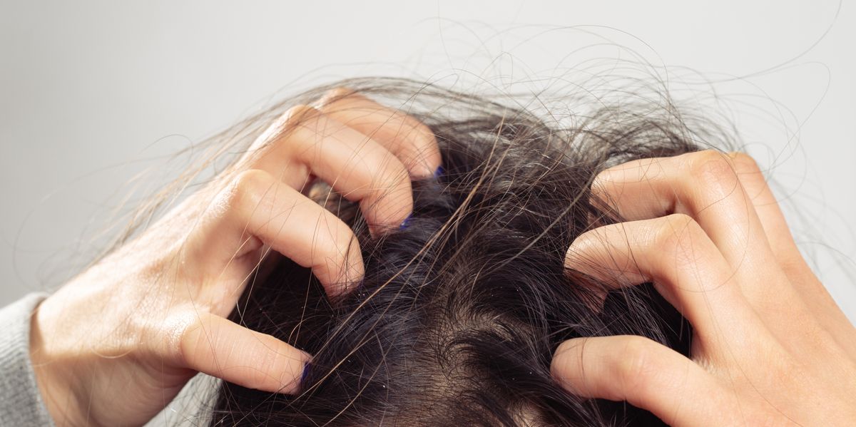 Itchy scalp causes and treatments