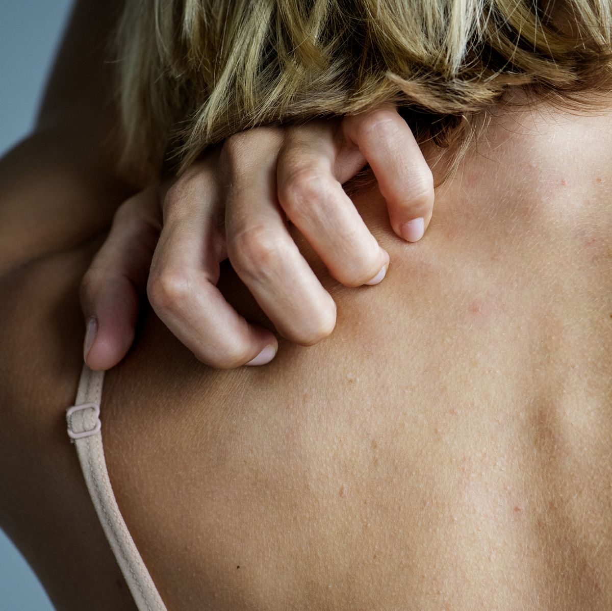 Itchy skin: 14 causes, pictures and treatments