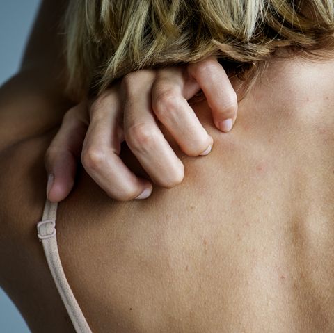 14 common causes of itchy skin