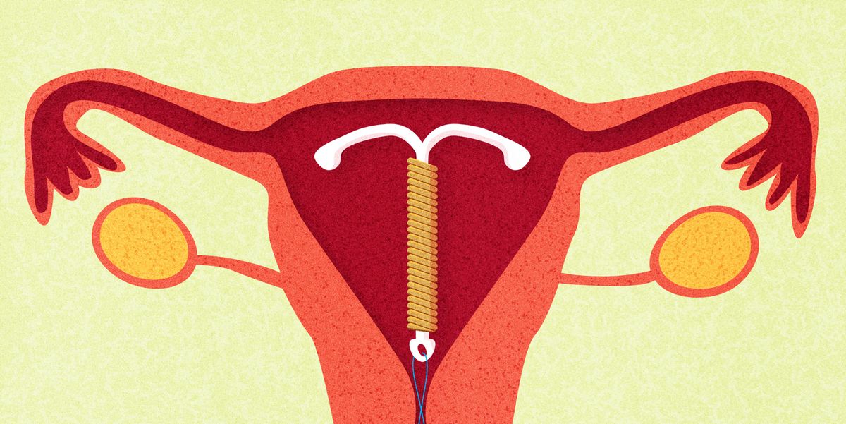 Sex With An Iud What You Need To Know