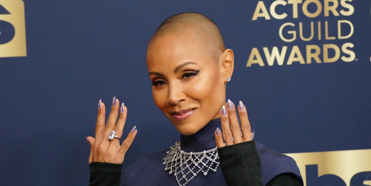 12 Celebrities Who Have Opened Up About Losing Their Hair