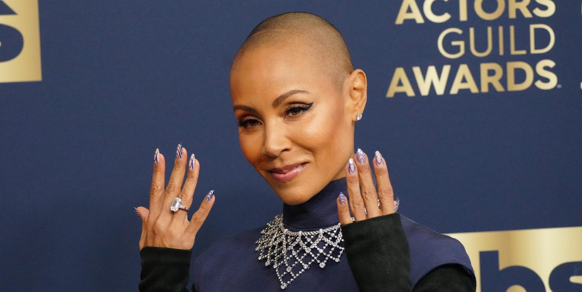 12 Celebrities Who Have Opened Up About Losing Their Hair