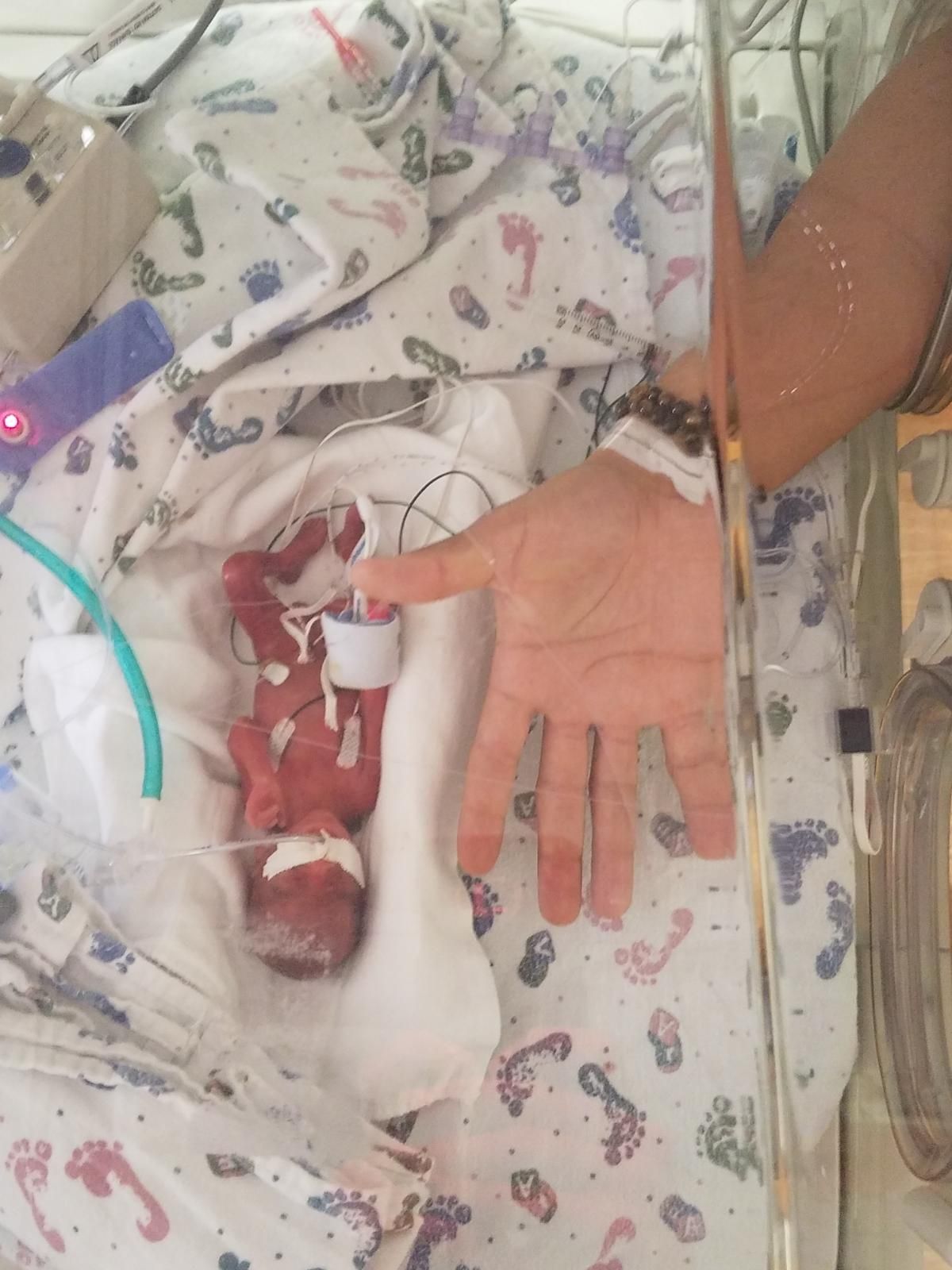 Iowa Woman Gives Birth To Baby Boy 4 Months Early Launches Gofundme