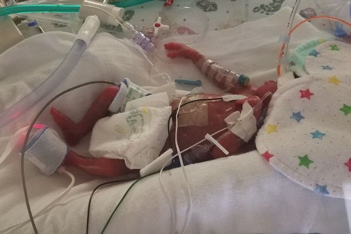 premature baby 4 months