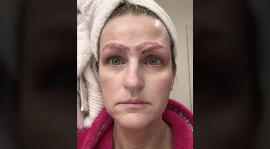 Woman’s Botched Microblading Procedure Left Her With Four Eyebrows