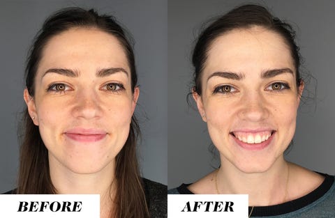 Does Drinking Water Help Your Skin - Facts on Drinking Water for Acne, Wrinkles, and Skin Problems Does Drinking Water Help Your Skin - Facts on Drinking Water for Acne, Wrinkles, and Skin Problems