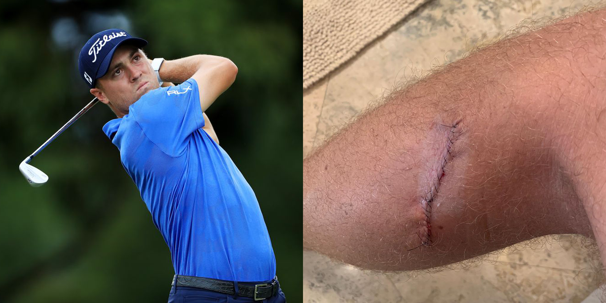 Pro Golfer Justin Thomas Shares Surgery Scar Photo After Melanoma Scare