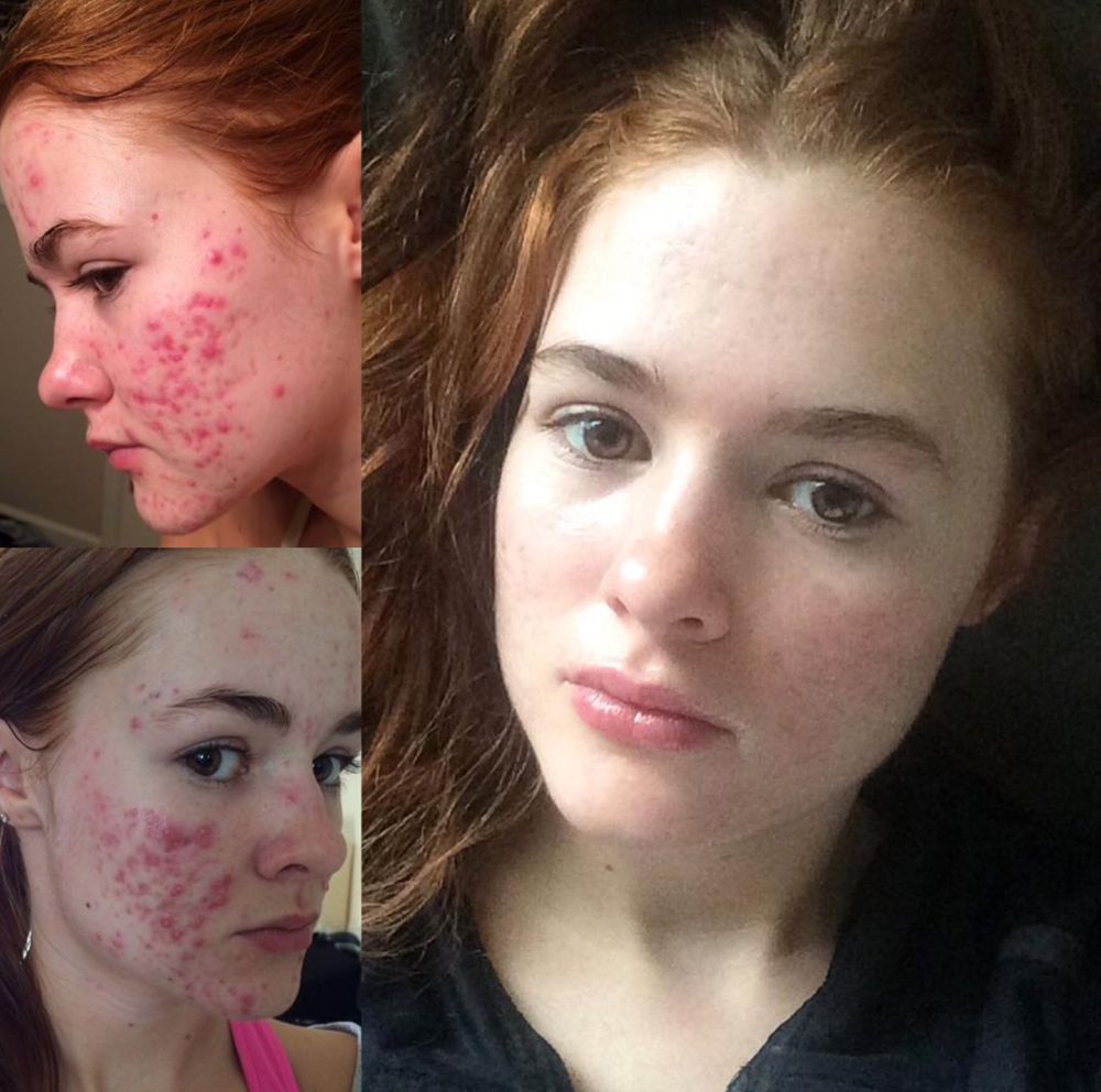 2019 year - This 21-Year-Old Has Become an Instagram Sensation for Her Crazy Before-and-After Pics 2019 year