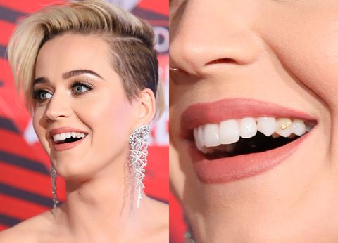 Katy Perry Had Quinoa in Her Teeth at the 2017 iHeartRadio Music Awards ...