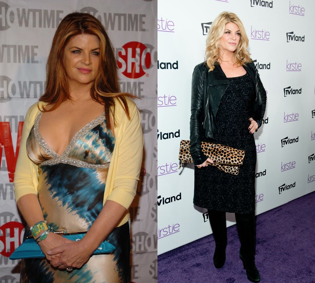 Kirstie Alley Weight Loss Surgery Weightlosslook