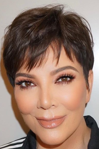 Kardashians Before and After Plastic Surgery – Kardashians Season 1 to Now