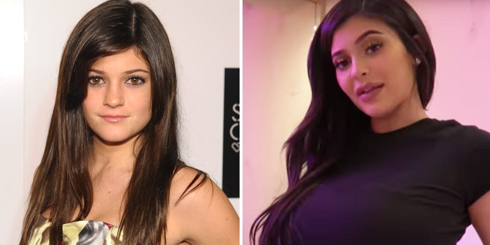 Kylie Jenner Beauty Transformation Timeline Kylie Jenner Makeup Throughout The Years 