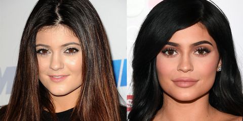 Image result for before and after kylie jenner