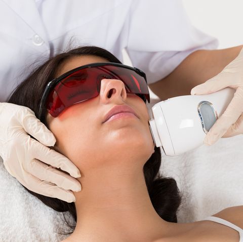 Laser hair removal facts