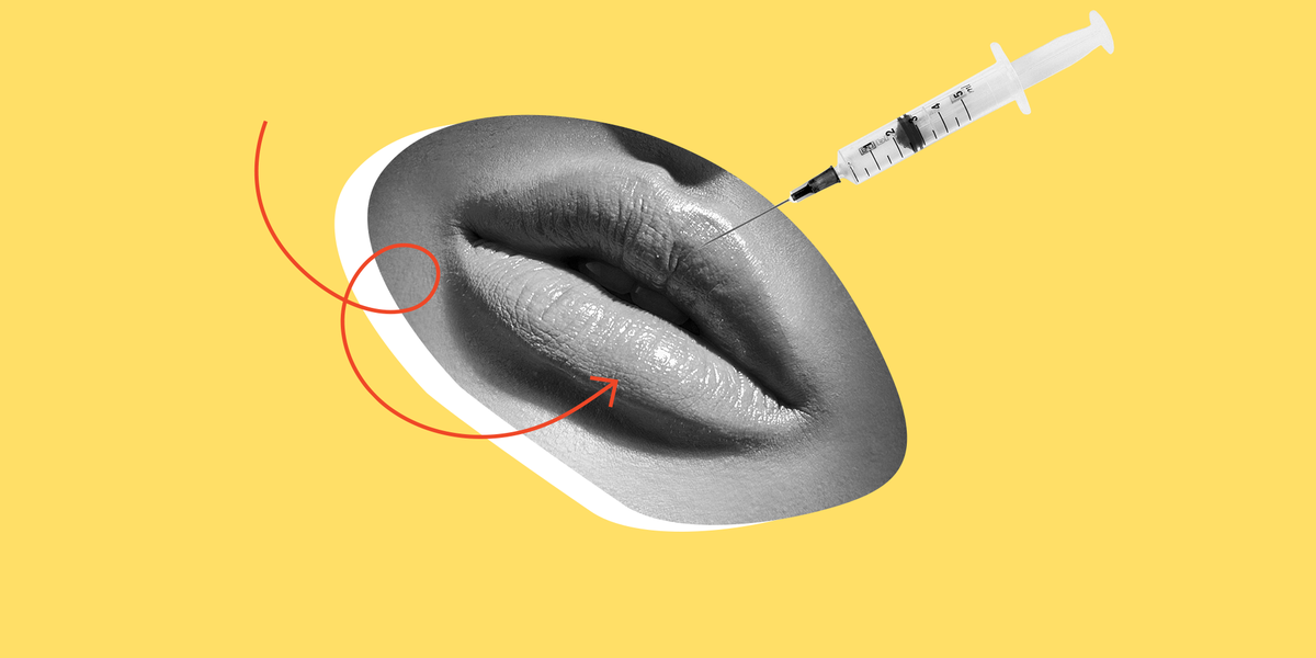 Your Ultimate Guide to Getting Lip Injections for the First Time