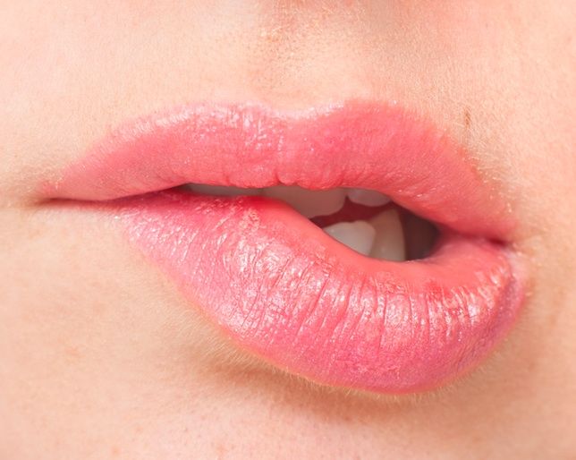 How To Heal Sunburned Lips Uk Lipstutorial Org