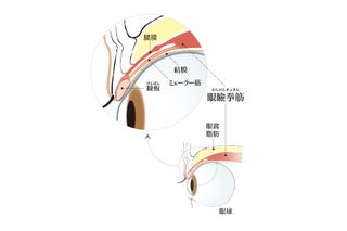 まぶたが下がる 眼瞼下垂 がんけんかすい ってなんですか