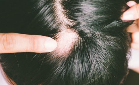 Why Is My Scalp So Itchy 10 Ways To Treat A Dry Itchy Scalp Why Is My Scalp So Itchy 10 Ways To Treat A Dry Itchy Scalp