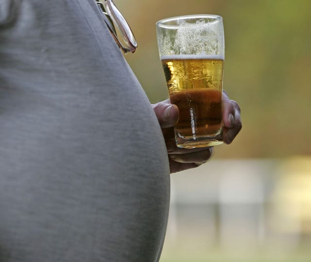 痛風 の6つの原因 ビール 魚卵より要注意の意外な食べ物は 痛風 の6つの原因 ビール 魚卵より要注意の意外な食べ物は