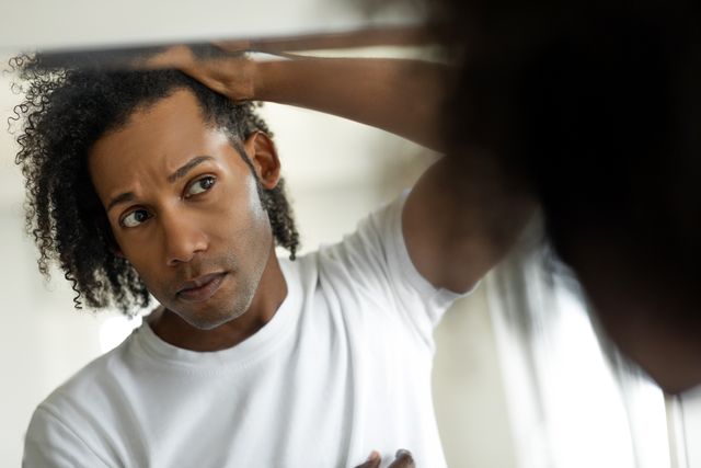 man worried for alopecia checking hair for loss