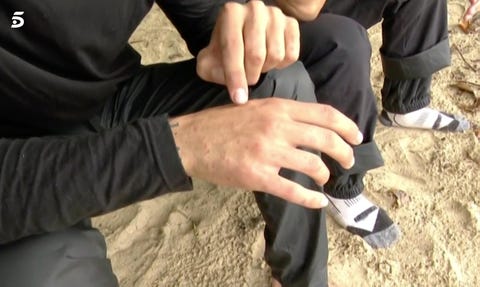 Barranco Barranco cuenta las más de 70 picaduras que tiene en una mano