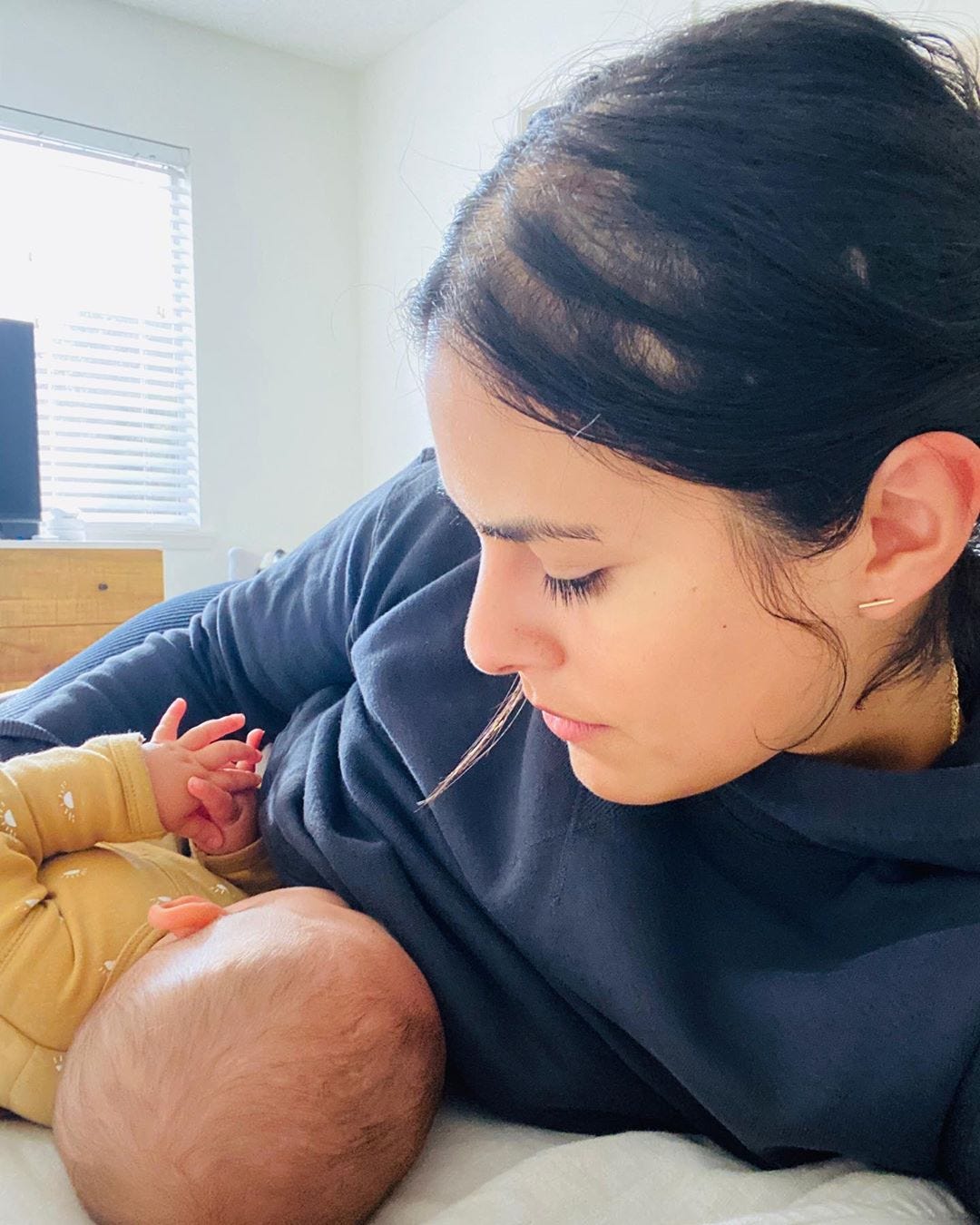 New Mom S Viral Photo Reveals The Struggle Of Postpartum Hair Loss