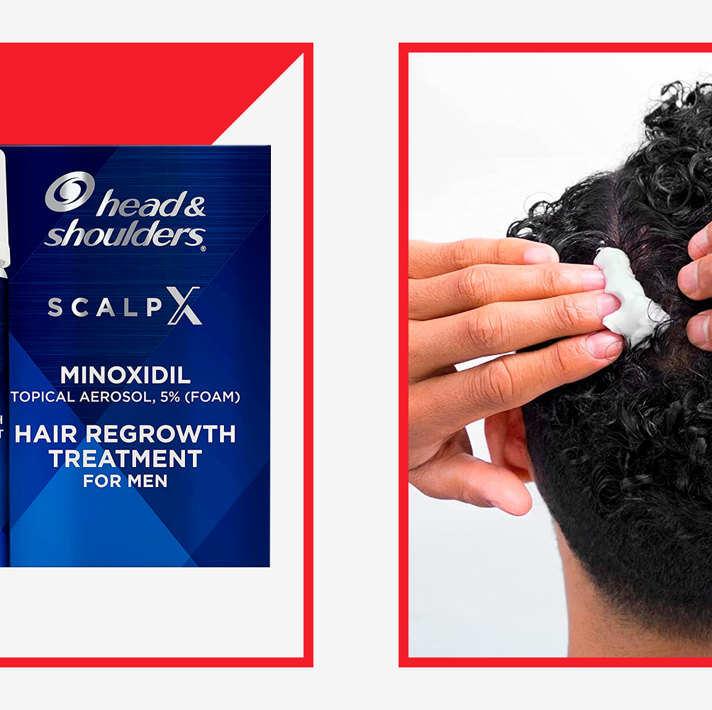 Inside Head & Shoulders' New Hair Loss Treatment That Actually Works
