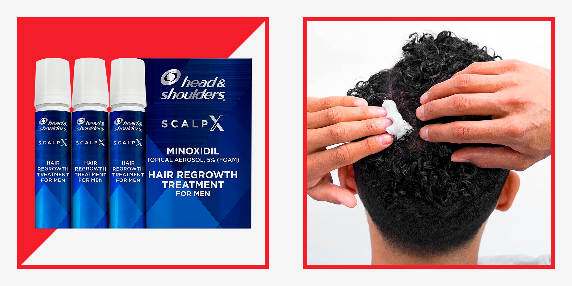 Inside Head & Shoulders' New Hair Loss Treatment That Actually Works