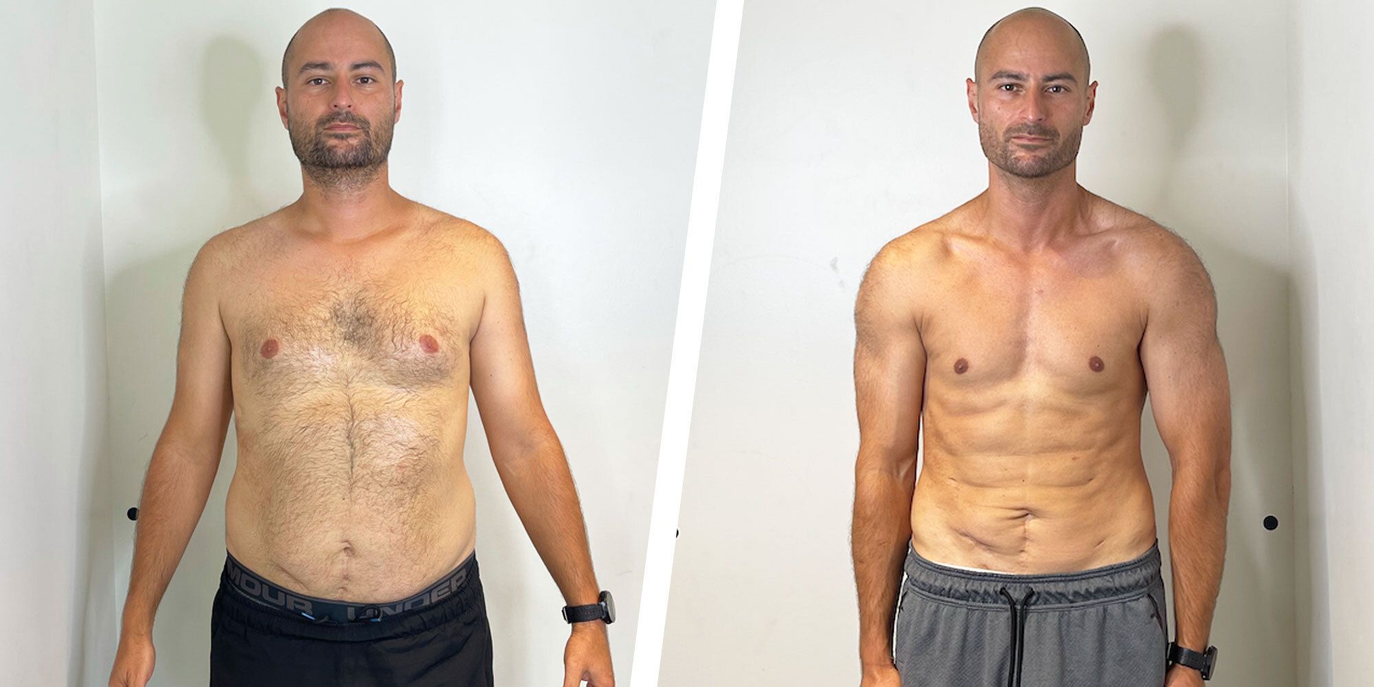 I Couldn’t Train My Abs for 10 Years. Now I Have a Six-Pack.