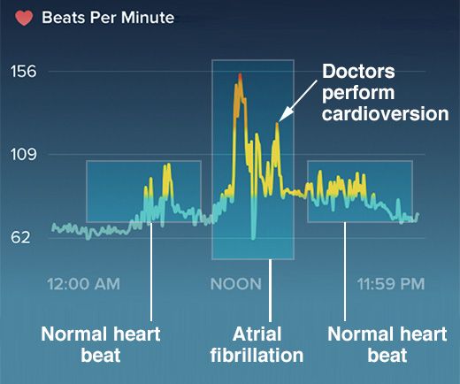 heartbeat on fitbit