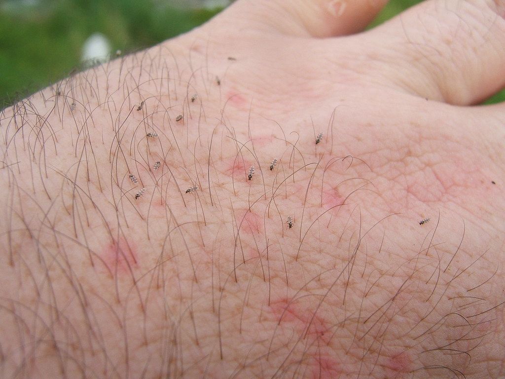 Cortisone Creams Are Powerful Skin Healers For Bites and Rashes Cortisone Creams Are Powerful Skin Healers For Bites and Rashes