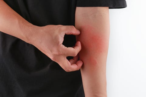 https://hips.hearstapps.com/hmg-prod.s3.amazonaws.com/images/midsection-of-man-scratching-while-standing-against-royalty-free-image-903999812-1548870860.jpg?crop=1xw:1xh;center,top&resize=480:*